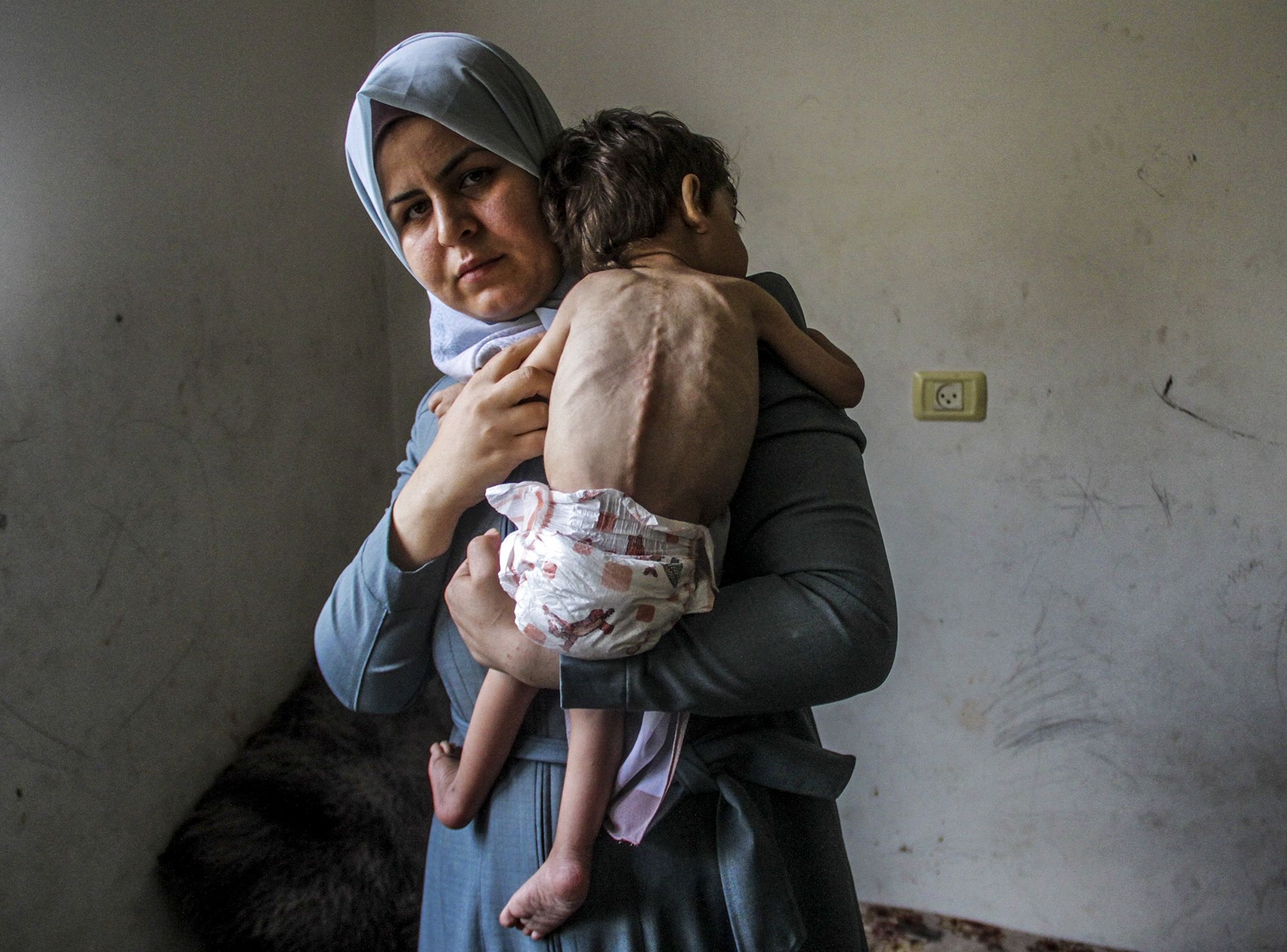 Baby Boy Starves to Death in Gaza Amid Growing Hunger Crisis, Medics Say